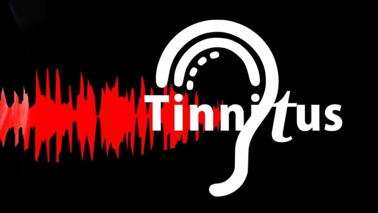 CBD for Tinnitus