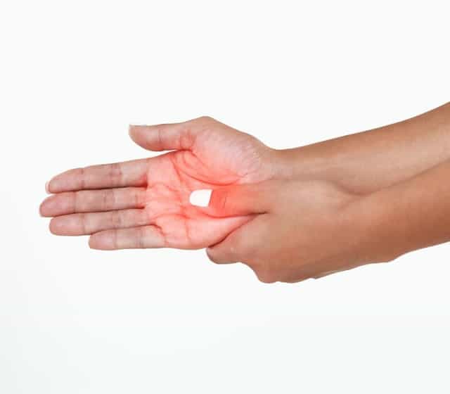 CBD Dosage for Arthritis