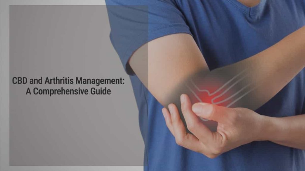 CBD and Arthritis Management: A Comprehensive Guide