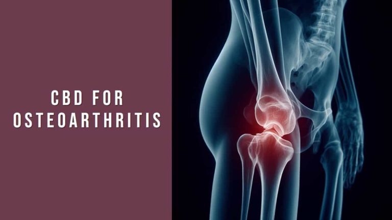 CBD for Osteoarthritis