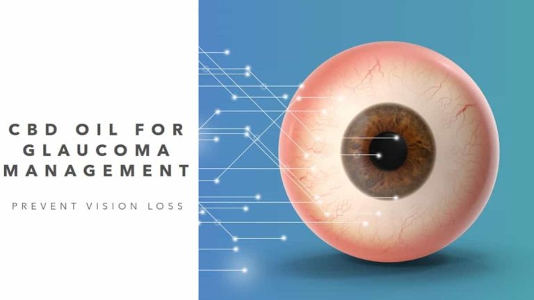 CBD Oil for Glaucoma Management