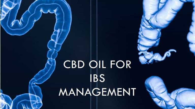 CBD Oil for IBS Management