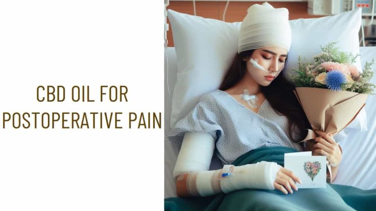 Using CBD Oil for Postoperative Pain