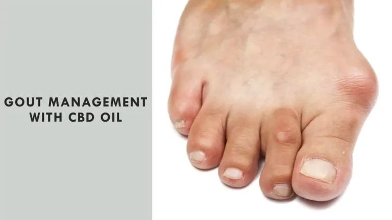 CBD Oil for Gout Management