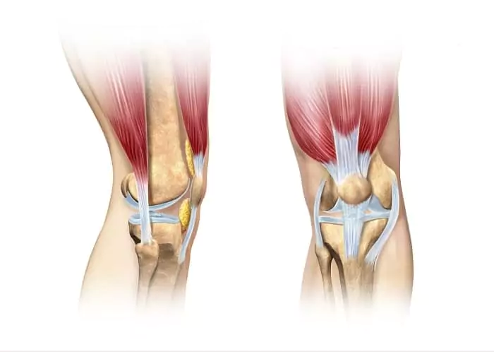 CBD vs NSAIDs for Tendonitis