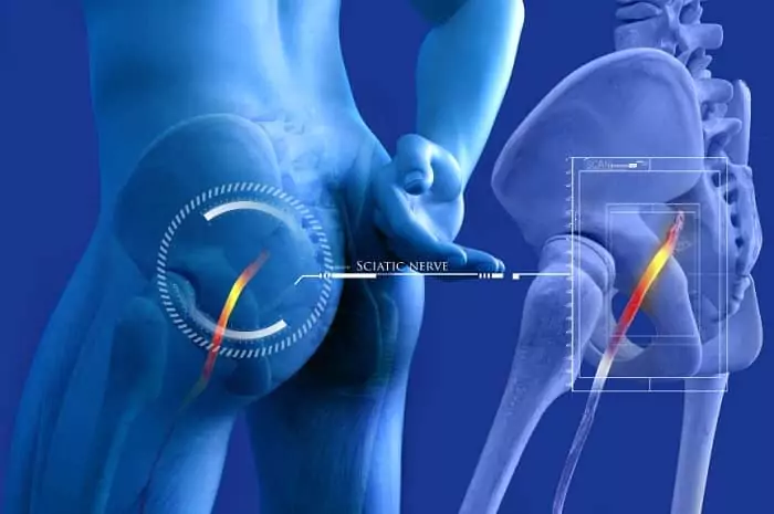 Side Effects of Using CBD for Sciatica Pain