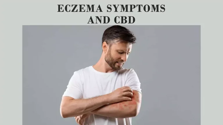 The Eczema Symptoms and CBD