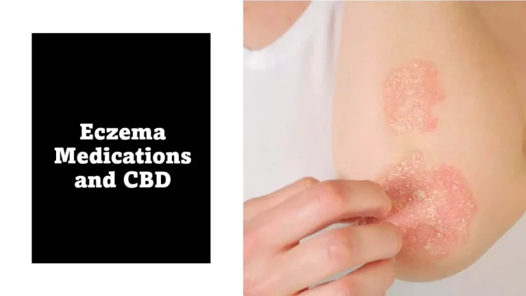 Using CBD to Manage Eczema Symptoms